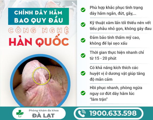 Hình ảnh minh họa